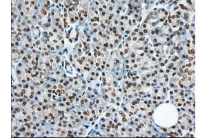 Immunohistochemical staining of paraffin-embedded Human Kidney tissue using anti-TACC3 mouse monoclonal antibody. (TACC3 antibody)