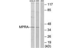 Western blot analysis of extracts from 293/COLO cells, using MPRA Antibody.