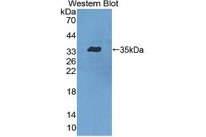 Figure. (LSP1 antibody  (AA 126-330))