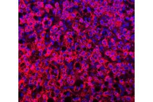 IF analysis of TTLL2 using anti-TTLL2 antibody (ABIN7600850). (TTLL2 antibody  (AA 24-582))