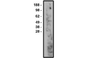 Image no. 1 for anti-Sphingomyelin Phosphodiesterase 3 (SMPD3) antibody (ABIN265269)