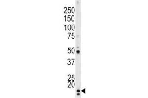 Western Blotting (WB) image for anti-Cyclin-Dependent Kinase Inhibitor 1A (p21, Cip1) (CDKN1A) (pThr145) antibody (ABIN3031122)
