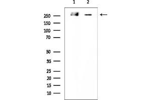 Western blot analysis of lysates from various samples, using ACC1 Mouse Monoclonal Antibody at 1/1000 dilution.
