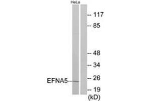 Western blot analysis of extracts from HeLa cells, using EFNA5 Antibody. (Ephrin A5 antibody  (AA 31-80))