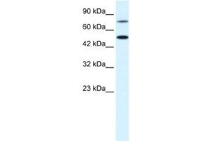 WB Suggested Anti-CHML Antibody Titration:  0.