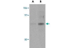 Western blot analysis of ACBD3 in K-562 cell lysate with ACBD3 polyclonal antibody  at (A) 1 and (B) 2 ug/mL . (ACBD3 antibody  (N-Term))