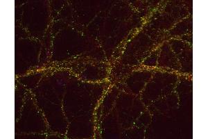 Indirect immunostaining of PFA fixed rat hippocampus neurons with anti-DAP 1 (dilution 1 : 500; green) and mouse anti-synapsin 1 (, dilution 1 : 500; green). (DAP antibody  (AA 721-778))