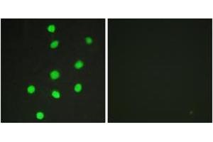 Immunofluorescence analysis of HepG2 cells, using GLI-3 Antibody. (GLI3 antibody  (AA 11-60))