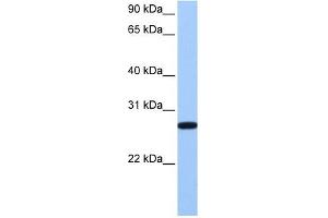 ECT2 antibody used at 1 ug/ml to detect target protein. (ECT2 antibody  (Middle Region))