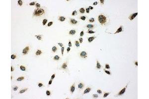 ICC: A549 cells (CACYBP antibody  (Middle Region))