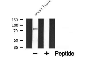 Western blot analysis of extracts from mouse brain, using GIT2 antibody. (GIT2 antibody  (Internal Region))
