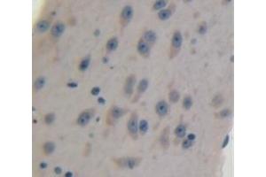 #VALUE! (LIMCH1 antibody  (AA 21-125))