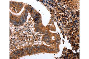 Immunohistochemistry (IHC) image for anti-C-Type Lectin Domain Family 4, Member A (CLEC4A) antibody (ABIN1871908)