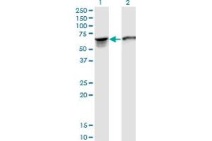 Western Blot analysis of STIP1 expression in transfected 293T cell line by STIP1 monoclonal antibody (M35), clone 2E11. (STIP1 antibody  (AA 1-543))