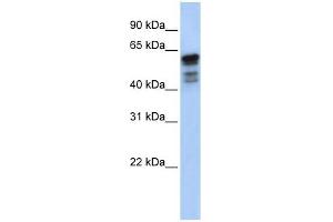Desmin antibody used at 1 ug/ml to detect target protein. (Desmin antibody  (Middle Region))
