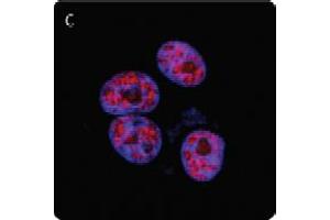 Image no. 2 for anti-Poly (ADP-Ribose) Polymerase 1 (PARP1) (N-Term) antibody (ABIN307559) (PARP1 antibody  (N-Term))