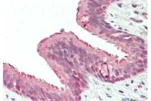 Rabbit Anti-RNF165 antibody  Formalin Fixed Paraffin Embedded Tissue: Human Lung, Respiratory Epithelium Primary antibody Concentration: 1:100 Secondary Antibody: Donkey anti-Rabbit-Cy3 Secondary Antibody Concentration: 1:200 Magnification: 20x Exposure Time: 0. (RNF165 antibody  (Middle Region))