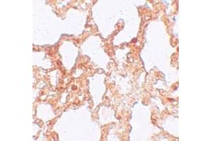Immunohistochemistry (IHC) image for anti-Zinc Finger, MYM-Type 1 (ZMYM1) (C-Term) antibody (ABIN1030824) (ZMYM1 antibody  (C-Term))