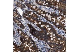 Immunohistochemical staining of human duodenum shows strong positivity in glandular cells. (CBR1 antibody)