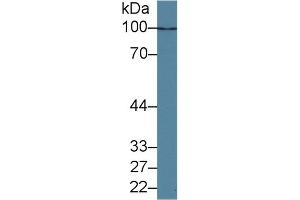Detection of HDAC9 in Human K562 cell lysate using Polyclonal Antibody to Histone Deacetylase 9 (HDAC9) (HDAC9 antibody  (AA 23-343))