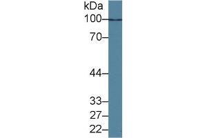 Detection of HDAC9 in Human K562 cell lysate using Polyclonal Antibody to Histone Deacetylase 9 (HDAC9) (HDAC9 antibody  (AA 23-343))