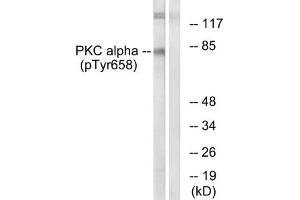 Western blot analysis of extracts from COLO205 cells using PKC α (Phospho-Tyr658) Antibody. (PKC alpha antibody  (pTyr658))
