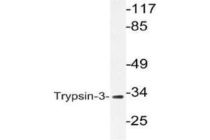 Western blot (WB) analysis of Trypsin-3 antibody in extracts from A549 cells (PRSS3 antibody)