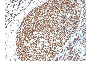 Formalin-fixed, paraffin-embedded human Tonsil stained with Histone H1 Rabbit Polyclonal Antibody. (Histone H1 antibody)