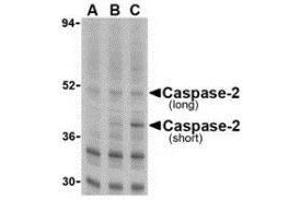 Western blot analysis of caspase-2 in Ramos cells with AP30196PU-N caspase-2 antibody at (A) 0.