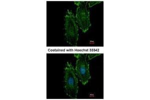 ICC/IF Image Immunofluorescence analysis of methanol-fixed HeLa, using RASGRP4, antibody at 1:500 dilution. (RASGRP4 antibody  (N-Term))