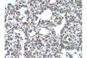 Immunohistochemistry (IHC) image for anti-Transmembrane Protease, serine 11D (TMPRSS11D) (N-Term) antibody (ABIN2782621) (TMPRSS11D antibody  (N-Term))
