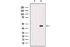 PRLHR antibody  (Internal Region)