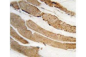 IHC analysis of FFPE human skeletal muscle tissue stained with PDK4 antibody (PDK4 antibody  (AA 83-111))