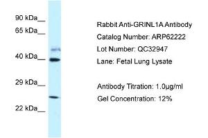 Western Blotting (WB) image for anti-Glutamate Receptor, Ionotropic, N-Methyl D-Aspartate-Like 1A (GRINL1A) (C-Term) antibody (ABIN2789070) (POLR2M antibody  (C-Term))