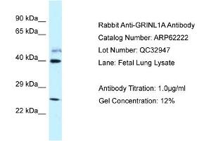 Western Blotting (WB) image for anti-Glutamate Receptor, Ionotropic, N-Methyl D-Aspartate-Like 1A (GRINL1A) (C-Term) antibody (ABIN2789070)