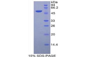 SDS-PAGE (SDS) image for Leucine-Rich alpha-2 Glycoprotein 1 (LRG1) (AA 136-342) protein (His tag,GST tag) (ABIN2123158)