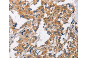 Immunohistochemistry (IHC) image for anti-Charged Multivesicular Body Protein 1A (CHMP1A) antibody (ABIN2423154) (CHMP1A antibody)