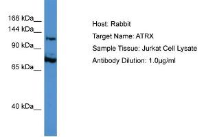 Host: Rabbit Target Name: ATRX Sample Type: Jurkat Whole Cell lysates Antibody Dilution: 1. (ATRX antibody  (C-Term))