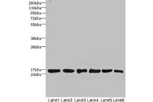 Western blot All lanes: SOD1 antibody at 6 μg/mL Lane 1: Mouse liver tissue Lane 2: Mouse brain tissue Lane 3: Hela whole cell lysate Lane 4: MCF-7 whole cell lysate Lane 5: A549 whole cell lysate Lane 6: HepG2 whole cell lysate Secondary Goat polyclonal to rabbit IgG at 1/10000 dilution Predicted band size: 16 kDa Observed band size: 16 kDa (SOD1 antibody  (AA 2-154))