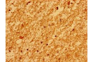 Immunohistochemistry of paraffin-embedded human brain tissue using ABIN7159593 at dilution of 1:100 (MARS2 antibody  (AA 225-460))