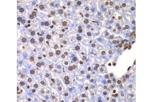 Immunohistochemistry of paraffin-embedded Mouse liver using ULK4 Polyclonal Antibody at dilution of 1:100 (40x lens). (ULK4 antibody)