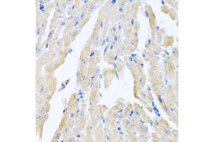 Immunohistochemistry of paraffin-embedded mouse heart using MLN antibody (ABIN6128307, ABIN6143890, ABIN6143891 and ABIN6222013) at dilution of 1:100 (40x lens). (Motilin antibody  (AA 26-115))