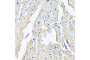 Immunohistochemistry of paraffin-embedded mouse heart using MLN antibody (ABIN6128307, ABIN6143890, ABIN6143891 and ABIN6222013) at dilution of 1:100 (40x lens). (Motilin antibody  (AA 26-115))