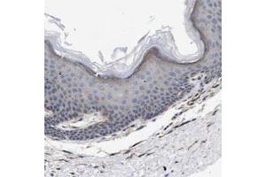 Immunohistochemical staining of human skin shows weak cytoplasmic positivity in epidermal cells. (WNT10A antibody)