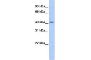 Image no. 1 for anti-Spermatogenesis and Oogenesis Specific Basic Helix-Loop-Helix 1 (SOHLH1) (AA 179-228) antibody (ABIN6742670) (SOHLH1 antibody  (AA 179-228))