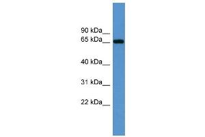 Western Blotting (WB) image for anti-Insulin-Like Growth Factor 2 mRNA Binding Protein 3 (IGF2BP3) (Middle Region) antibody (ABIN2778995)