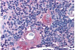 Human Thymus (formalin-fixed, paraffin-embedded) stained with RAB14 antibody ABIN214804 at 5 ug/ml followed by biotinylated goat anti-rabbit IgG secondary antibody ABIN481713, alkaline phosphatase-streptavidin and chromogen.