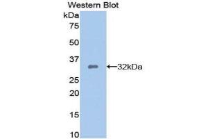 Western Blotting (WB) image for anti-Dickkopf Homolog 1 (DKK1) (AA 33-266) antibody (ABIN1858644) (DKK1 antibody  (AA 33-266))