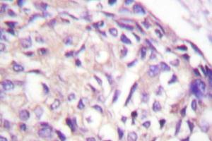 Immunohistochemistry analysis with AurA (pPro282) antibody on paraffin sections. (Aurora A antibody)