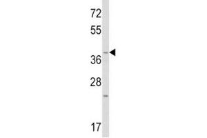 Western blot analysis of WNT1 antibody and mouse heart tissue lysate. (WNT1 antibody  (AA 260-288))